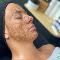 biopeeling-gezichtsbehandelingen-schoonheidsspecialiste-leiden-leiderdorp